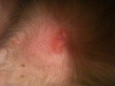 dog heat rash pictures. heat rash on hands and feet.