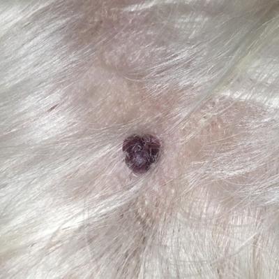 Dark Purple, Brown and Red Pea-Sized Skin Growth with 3 Close Bumps