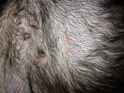 rash on Abby's abdomen