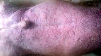 Belly Rash