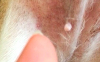 Tiny pimple