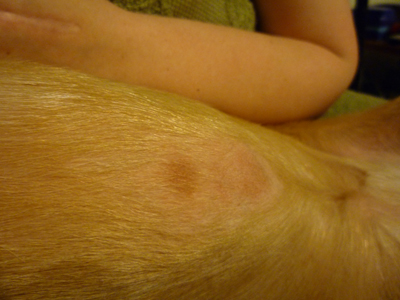 Bailey's Rash