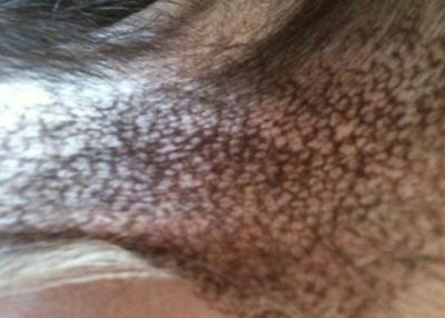 black scaly looking bald patch