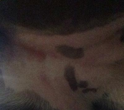 Bright red splotches