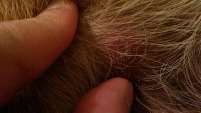 Raised Skin, Almost a Scab