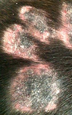 roundish hairless scaly itchy skin lesions on back and sides 21802979
