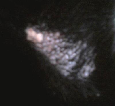 Scaly Growth on Left Elbow