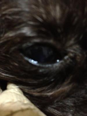 Left eye - normal