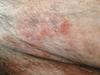 belly area. Are redder than in these pics