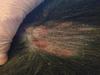 the area where I was scratching him where there is now a tiny bit of hair loss.