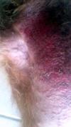 Underarm Rash