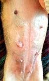Her stomach with barely visualable pimple and red spots